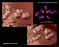 colony appearance of klebsiella pneumoniae, microscopic appearance